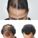 Preenchedor de Fibra Capilar – Cobre Falhas com Volume Natural